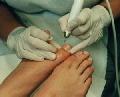 Pedicure