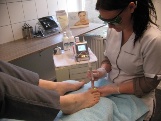 Last van kalknagels? Laserbehandeling voor gezonde en heldere nagels — foto 2