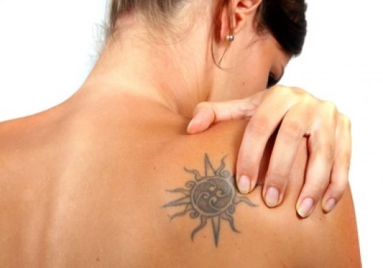 Laat uw tattoo verwijderen door een specialist! — foto 2